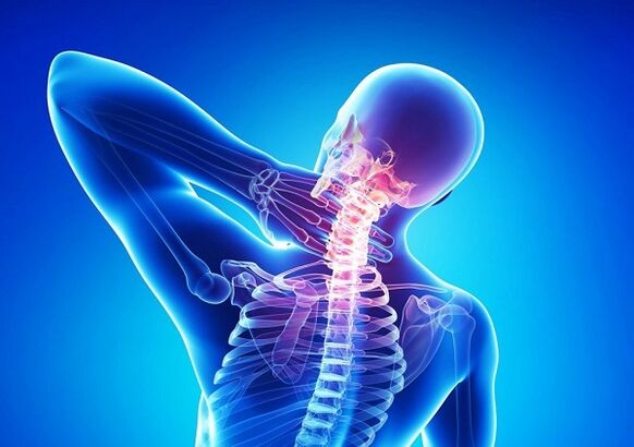 Dolor en la columna cervical con osteocondrosis