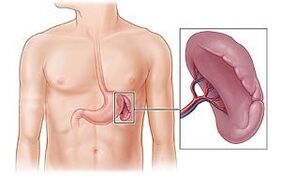patología del bazo como causa de dolor debajo del omóplato izquierdo