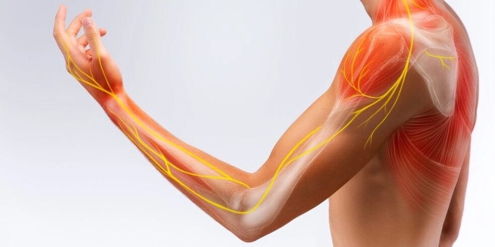 El dolor y el entumecimiento de los dedos indican daño a los ligamentos debido a ligamentitis estenosante.